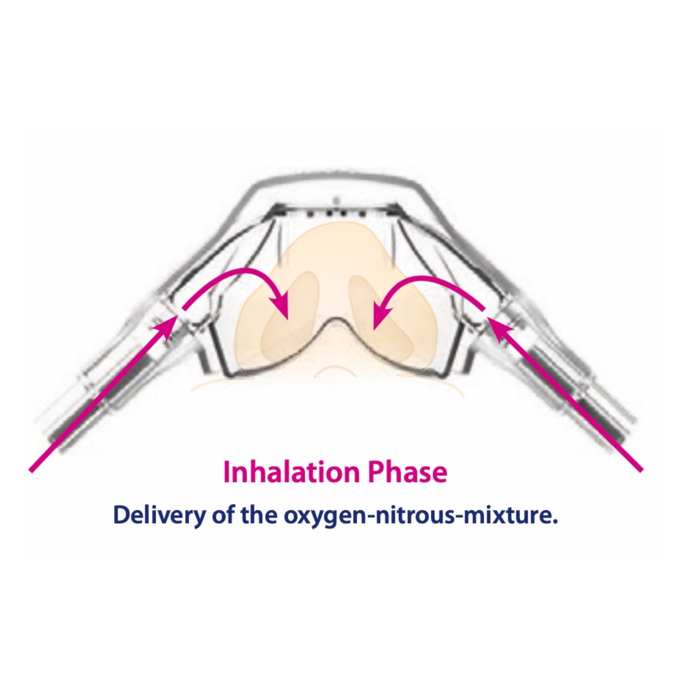 Baldus 16024-2 Double Nasal Mask Scavenger System for Adults with Vacuum Control Block - Image 3